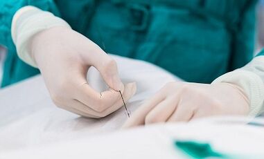 Diagnoza varikoznih žil majhne medenice